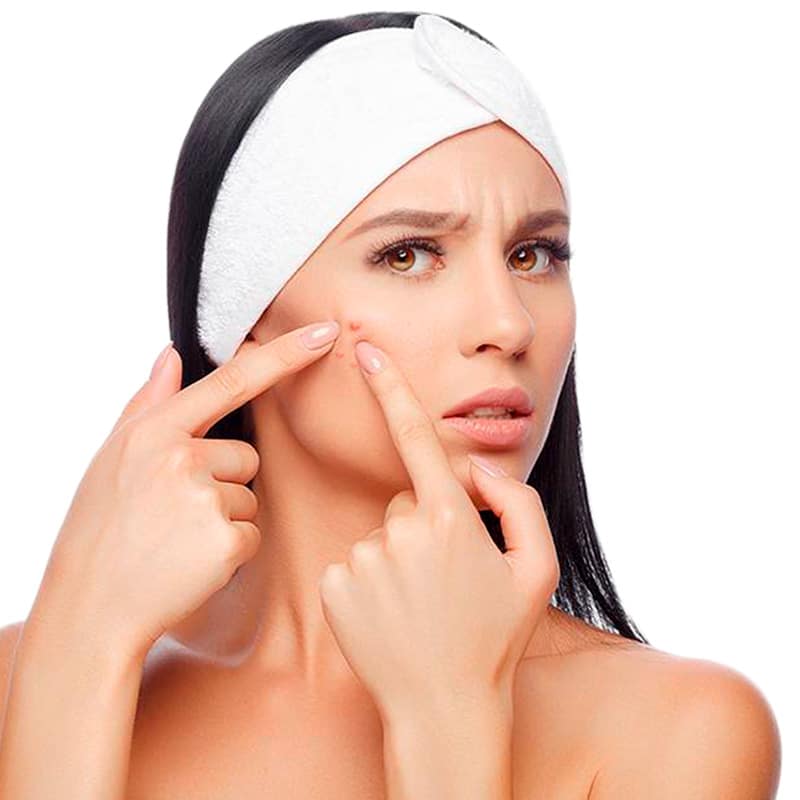 tratamientos-para-el-acne