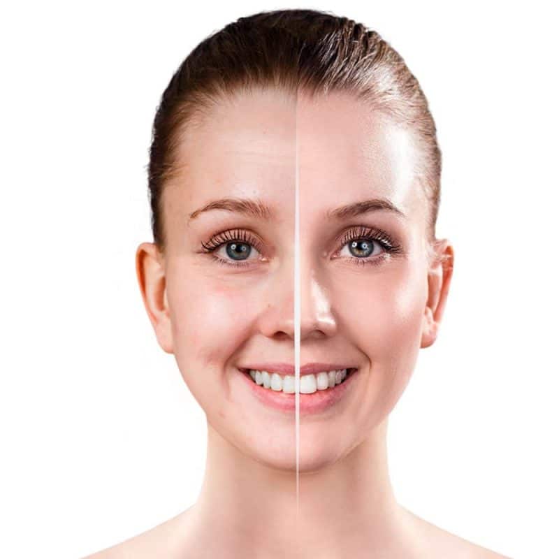 facial limpieza profunda